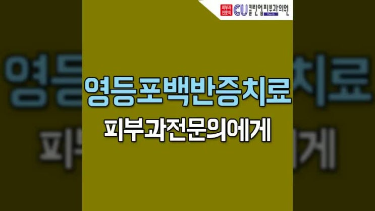  영등포백반증치료 방치 하지 말고 받아봐