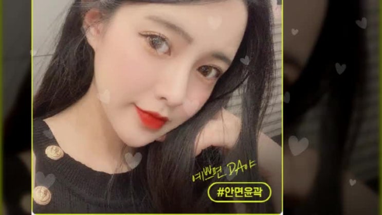  사각턱수술 부드러운 얼굴형!
