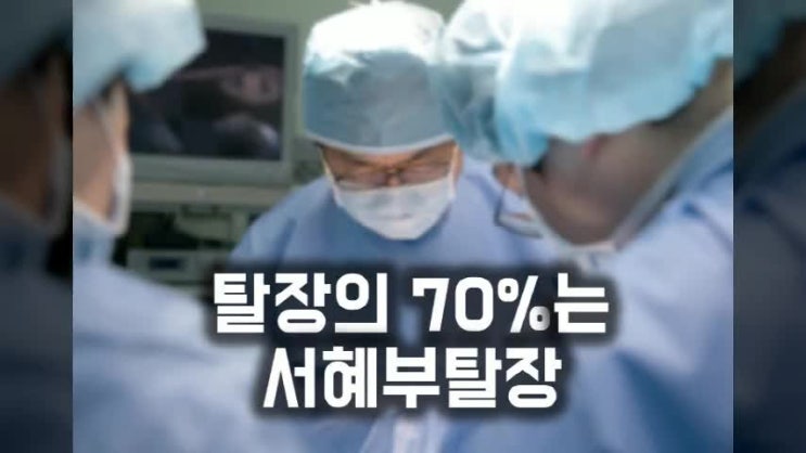  서혜부탈장수술 방법을 찾아보자!