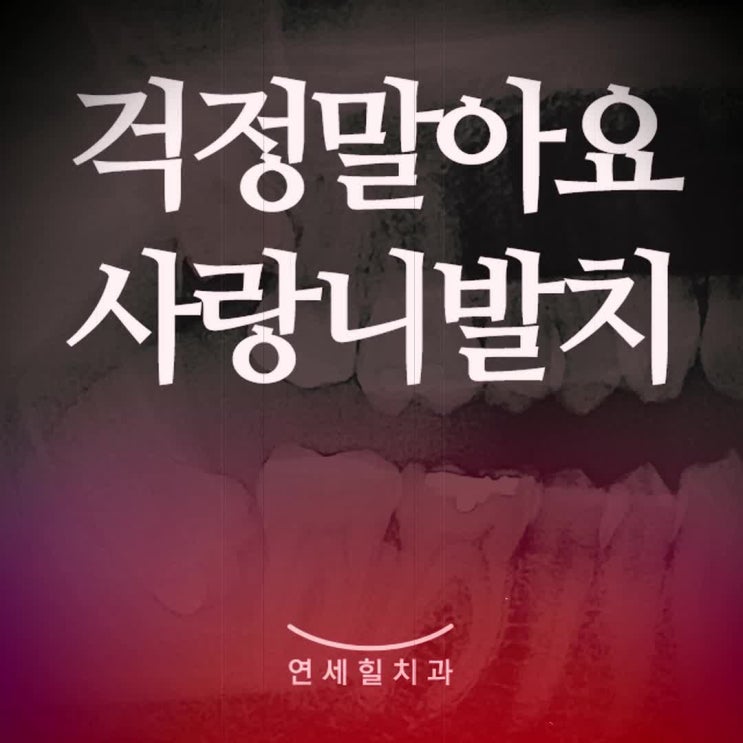  강서구사랑니 무섭고 아파서 미뤘다면