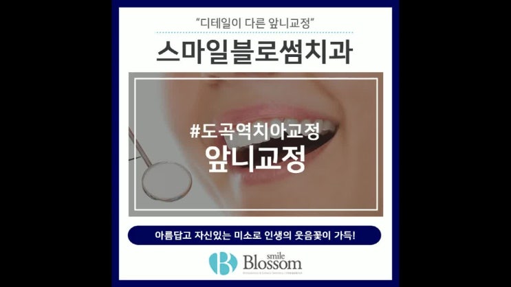  도곡역치아교정 앞니교정으로 얼굴과 조화롭게!