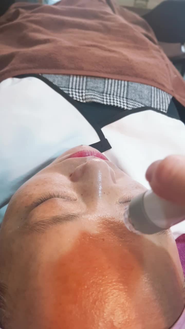  포승 피부관리 아쿠아필 시술 영상