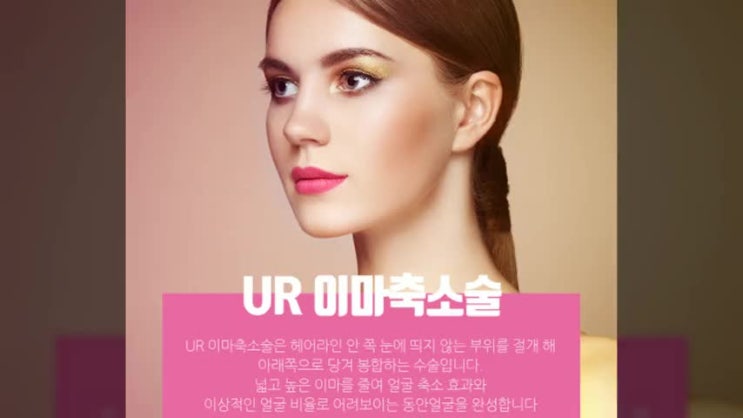  이마축소술비용 알아보고 있다면