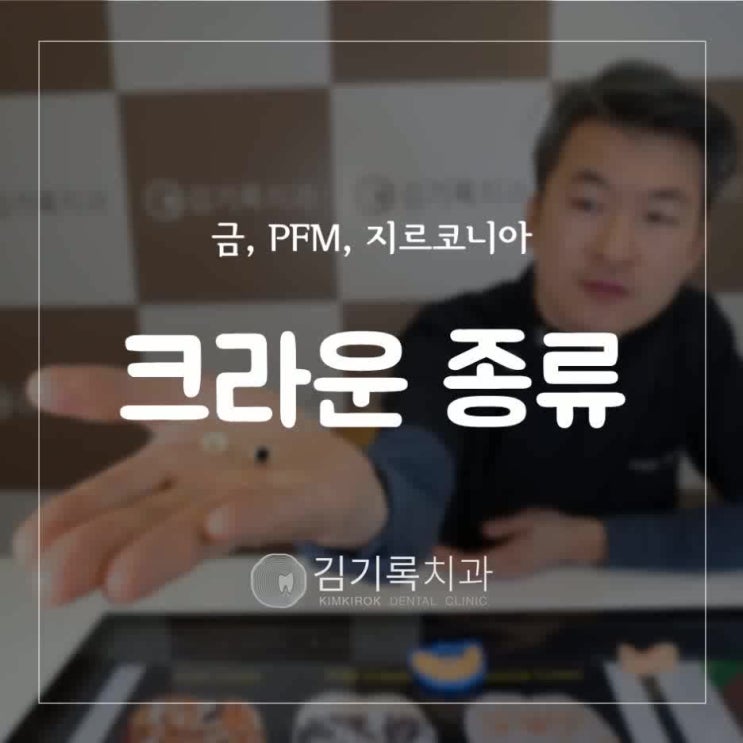 수원충치치료잘하는치과 보철 크라운 어떤 걸로 씌워야 해요? 치과 크라운 종류 골드 PFM 지르코니아