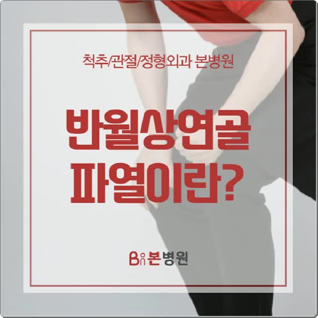  반월상연골파열로 안양 정형외과 찾으신다면