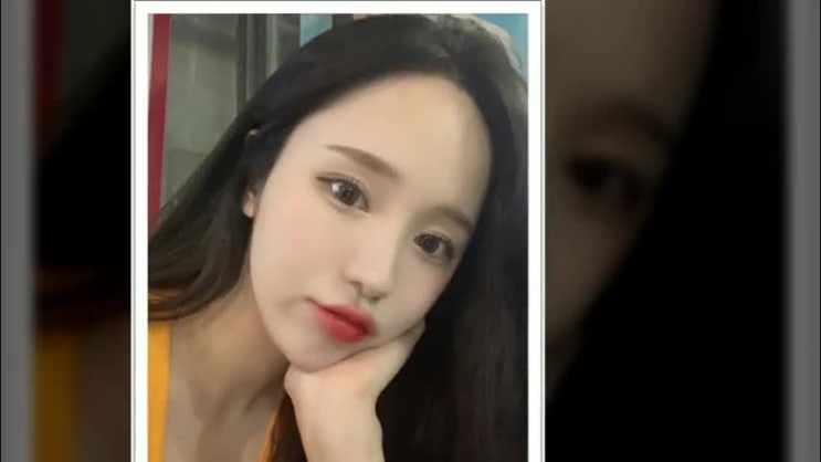  코성형잘하는곳 예쁜 코를 원한다면