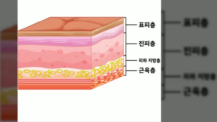  심재성 2도 화상 진단금 이란??