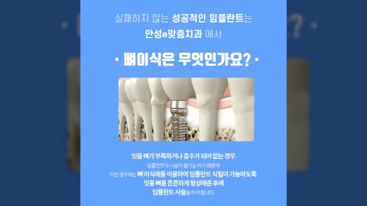  용이동치과 잇몸뼈가 거의 없는 경우 필요한 뼈이식임플란트
