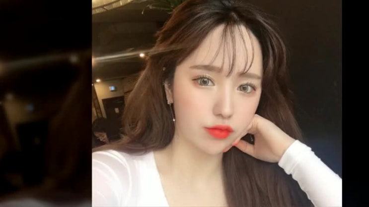  눈재수술병원 스트레스는 이제 그만