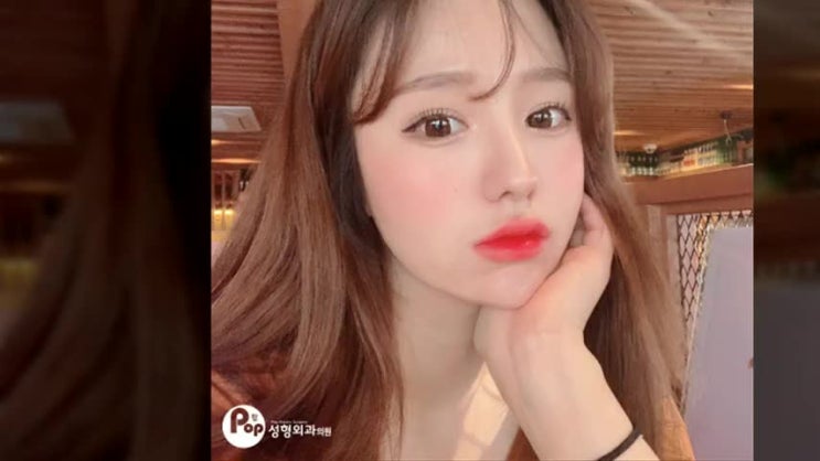  휜코재수술 원인은?