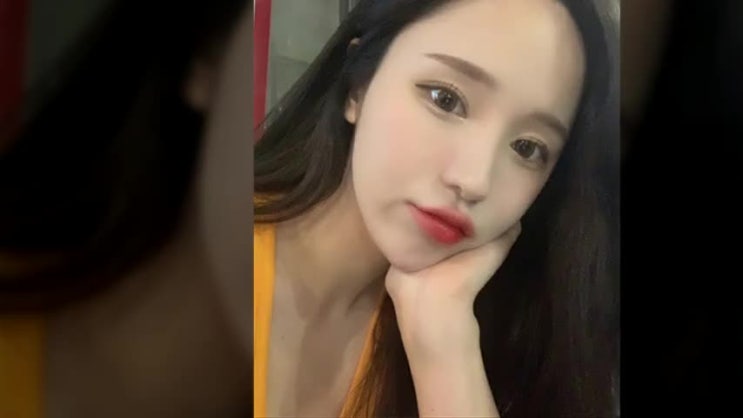  코성형수술비용 보다 중요한 이것