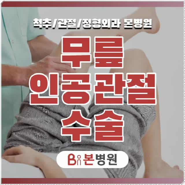  무릎인공관절수술 퇴행성 관절염 주의해요