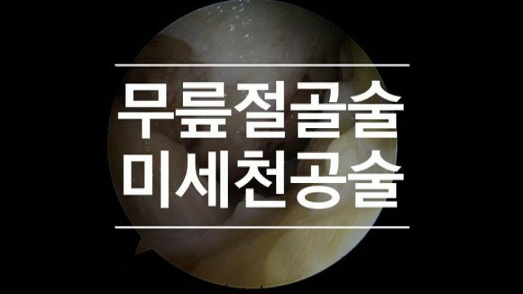  근위경골절골술 과 미세천공술 로 무릎연골재생