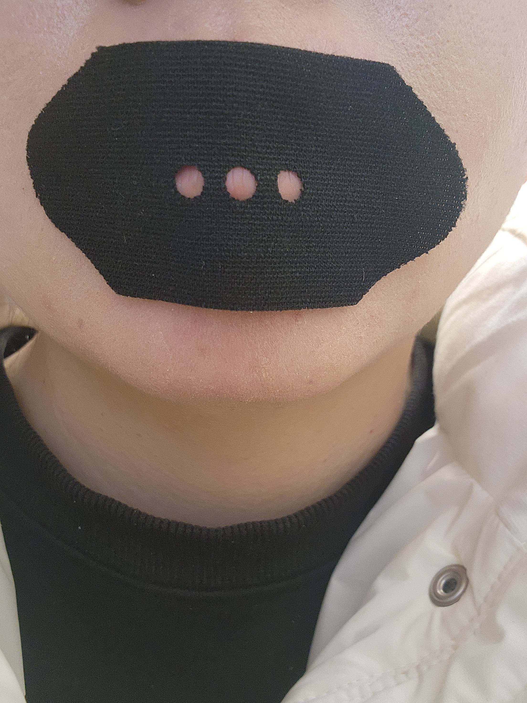 입벌림 방지 테이프 실제 제품 예시 1