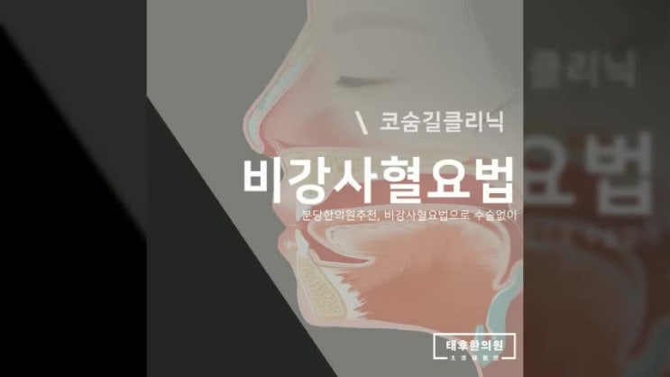 분당한의원추천, 비강사혈요법으로 수술없이 : 네이버 블로그