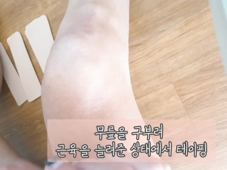 후기:) 스포츠 근육 테이핑 머슬맥스 운동요법 테이핑 키네시올로지 테이프 : 네이버 블로그