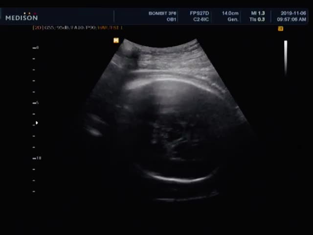  안양봄빛병원 36주 막달검사