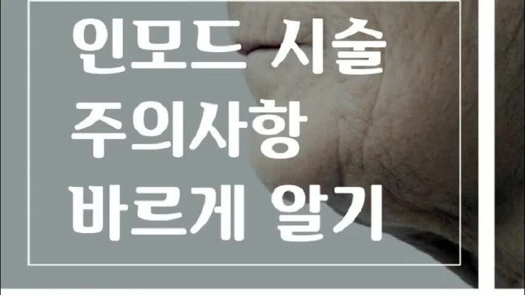  이중턱처진살 스트레스 인모드레이저 불독살 리프팅후기 가격