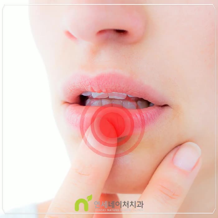  입술뜯는버릇 원인과 겨울철 건조한 입술 관리하는 방법!