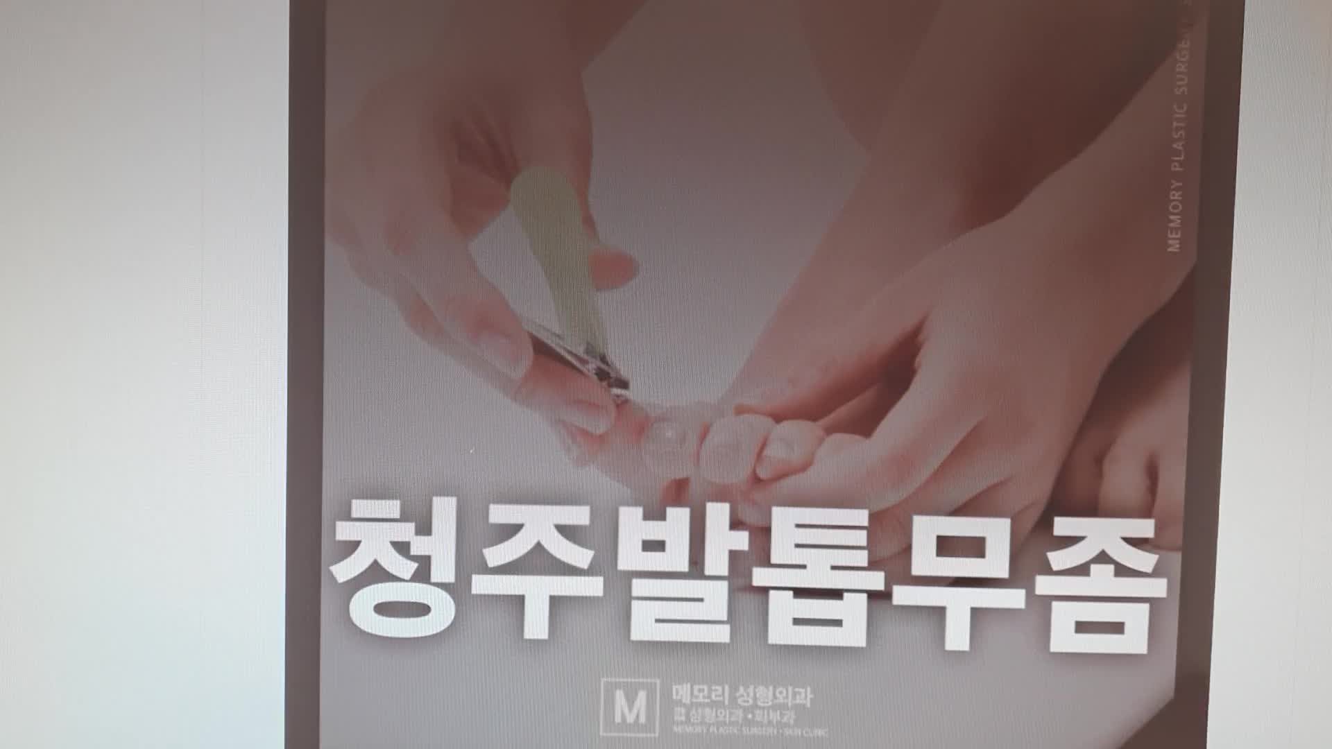 청주 발톱무좀 병원 고민마세요
