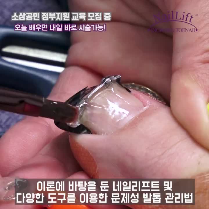  소상공인지원교육 문제성발톱관리