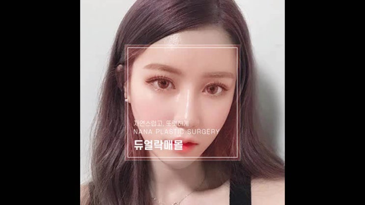  쌍꺼풀수술가격 섬세하게 알아봤다면