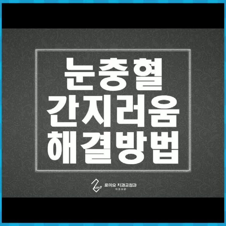  코로나 눈충혈 눈간지러움과 연관이 있을까? 혹시 바이러스 감염이 아닐까?