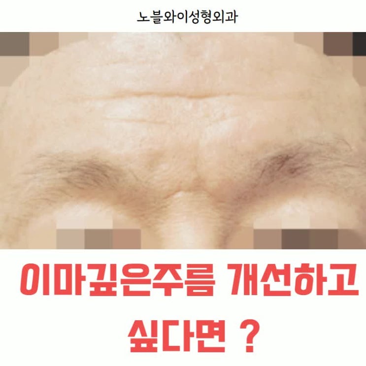  이마깊은주름 내시경이마눈썹거상술로 해결?