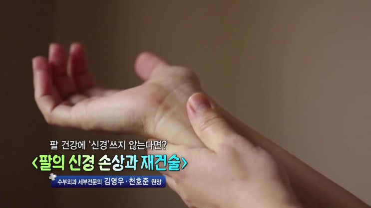 mbc 약손 손의 신경이 손상되는 원인과 치료방법