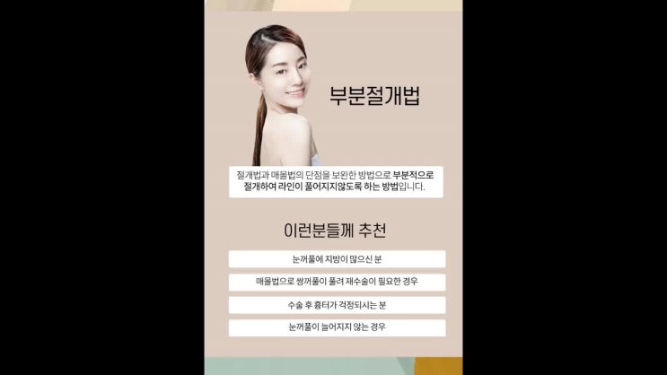  광주 쌍수 눈수술로 더 자신있어