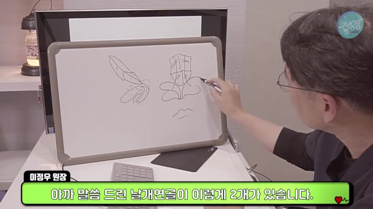  코끝비침은 흉터없는 측두근막으로-정우성형외과
