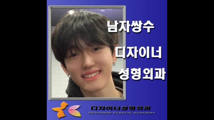  남자 쌍수 인라인으로 자신감 뿜뿜