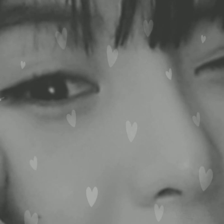  눈매교정부작용 나한테도 생겼네 어떻게 해주죠