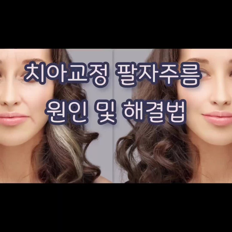  치아교정 팔자주름 원인과 해결법