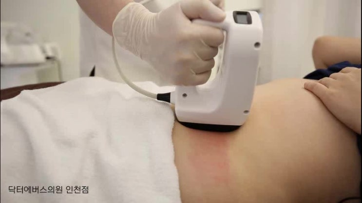  바디인모드레이저로 지방세포파괴와 처진 살 리프팅을 동시에!