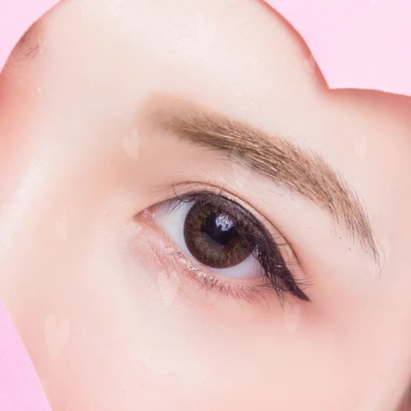  눈매교정재수술 내가 원하던게 이런거였어