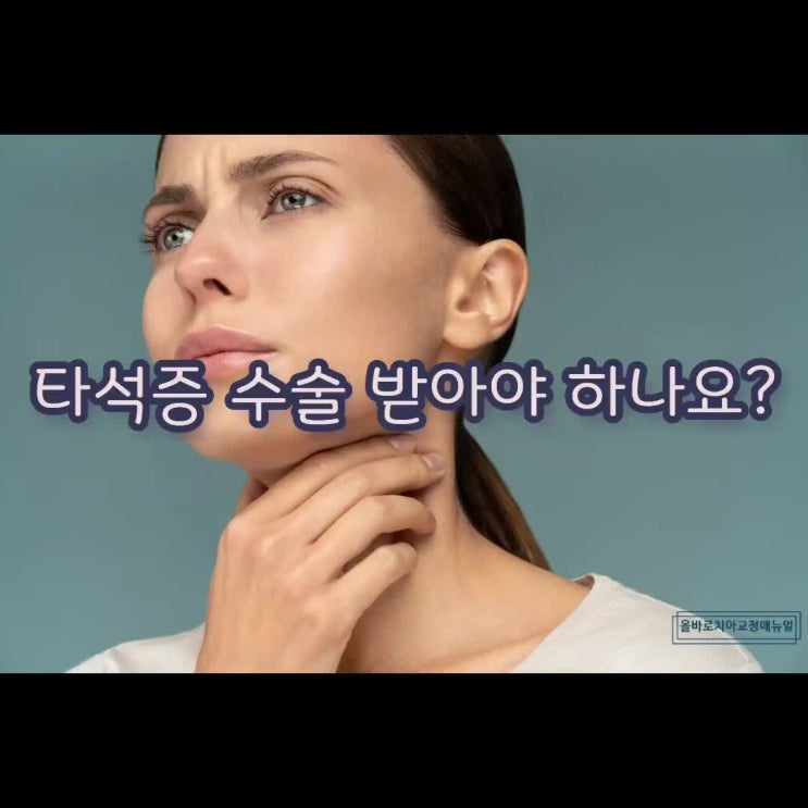  타석증 수술 받아야 하나요?