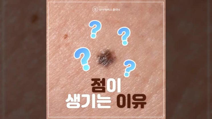  점이 생기는 이유가 궁금하다면 주안주변에서 점빼기 잘하는 여기서 알려드림
