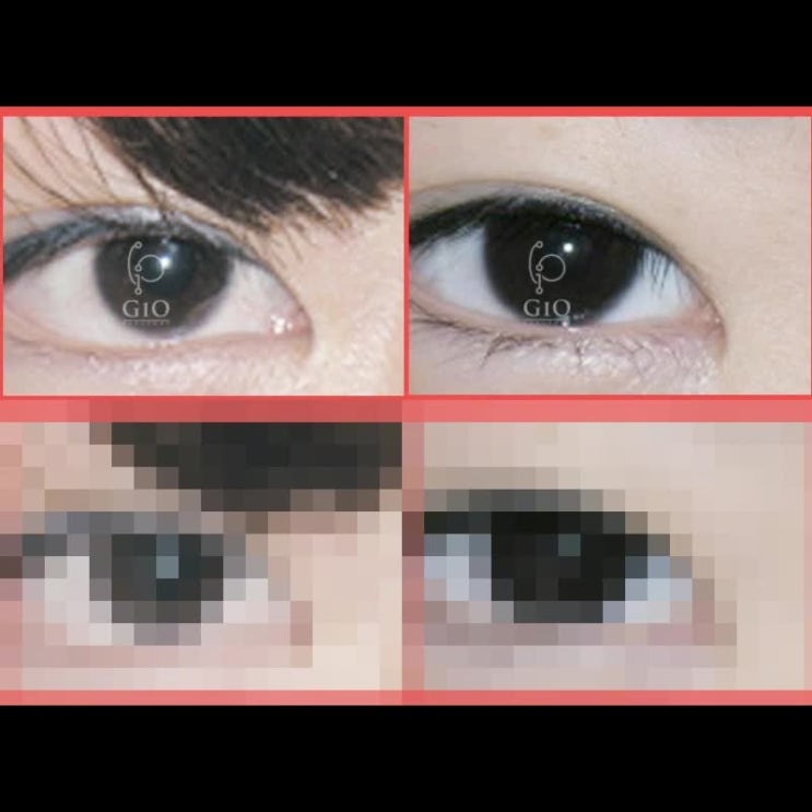  앞트임 풀림 효과가 부족하다면
