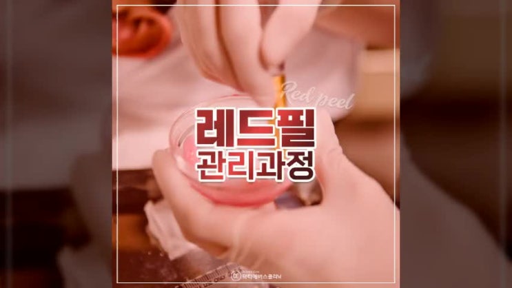  인천구월동피부과잘하는곳. 여드름에 좋은 필링 레드필과정은 어떻게 될까