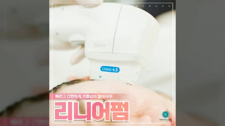  빈틈없이 탄력채워주는 리니어펌. 부평근처에 잘하는곳에서 받고 탄력올리자