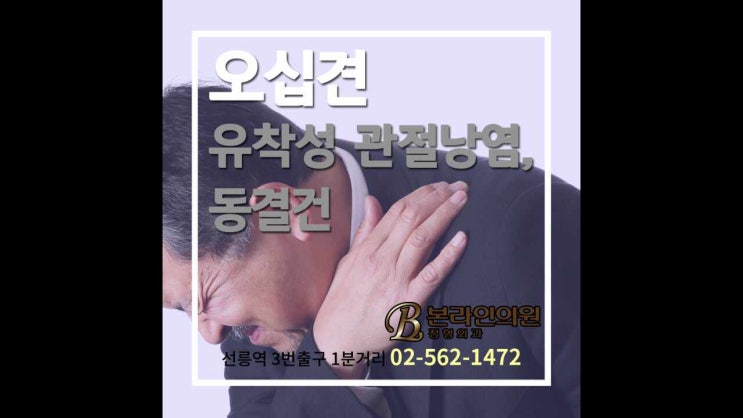  오십견 치료 방법부터 오십견 스트레칭, 오십견에 좋은 운동법
