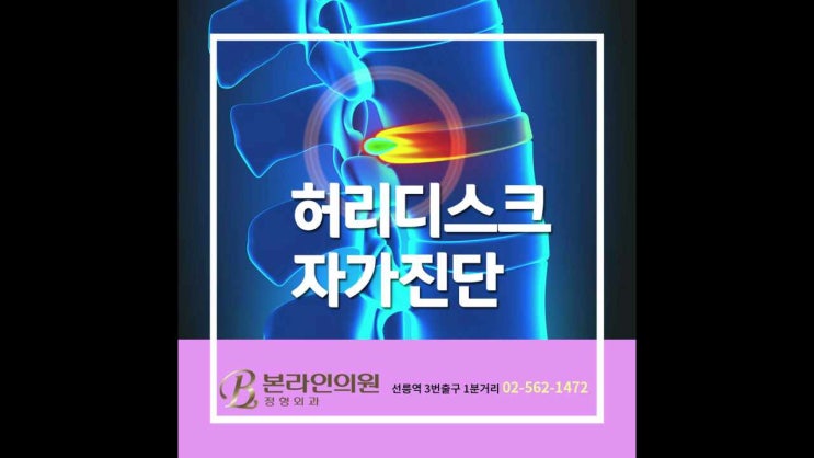  허리디스크 자가진단 어떻게 하나요?