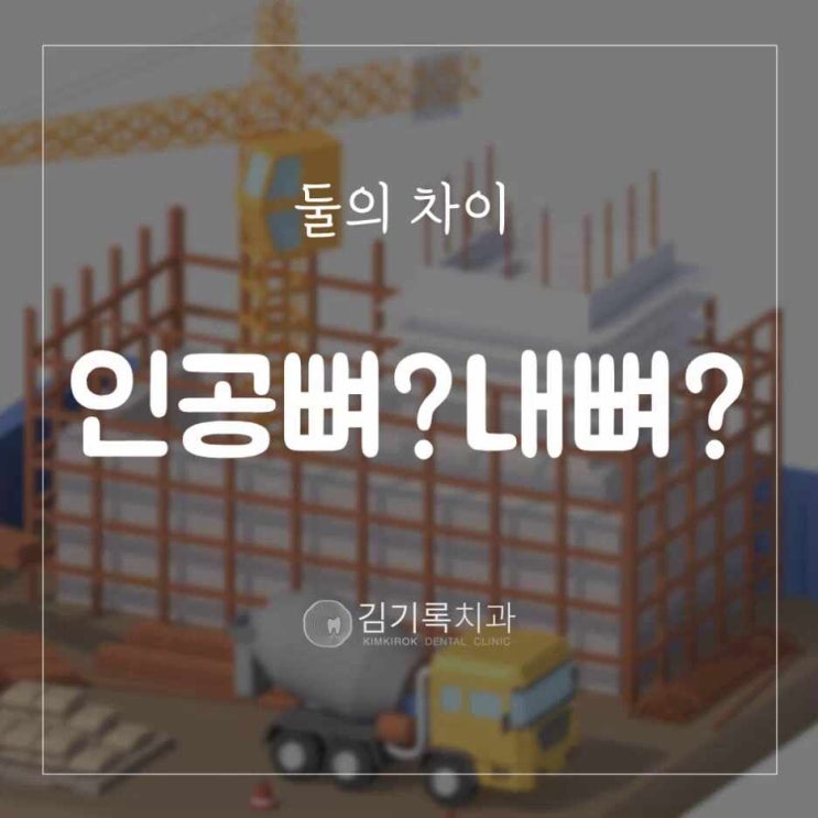 장안구치과 뼈이식을 한 뼈와 내 뼈는 어떻게 다를까? 이식한 뼈와 내 뼈와의 차이!