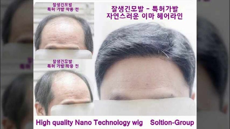  형상기억인모로 헤어패치를 만들어도