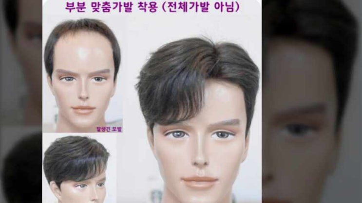  생활의 달인 가발을 쓰고 결혼과 취업걱정을