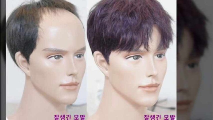  남자 맞춤 가발가격만큼 중요한 포인트는