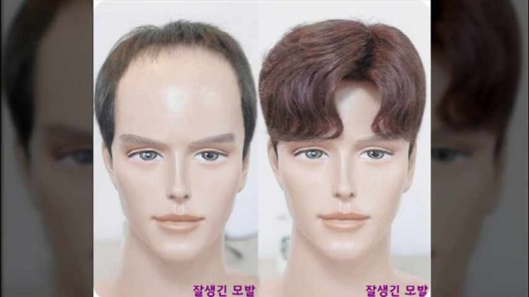  정수리인모가발 쓰는법으로 매장에서 앞머리부분도