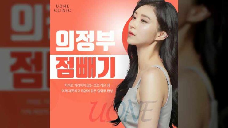  의정부, 회룡점빼기로 깔끔한 얼굴 완성. 피부과진료 유원의원