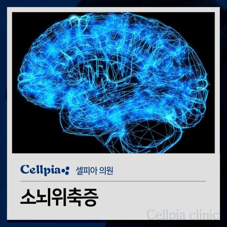 소뇌위축증 원인 단순 노화 현상으로 생각하기보다는 : 네이버 블로그
